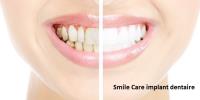 Smile Care Dental Clinic image 5